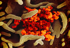 The biological makeup of the coronavirus as seen beneath a microscope. 